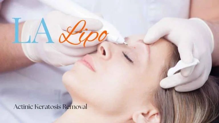Woman receiving Actinic Keratosis Removal Treatment Bricket Wood
