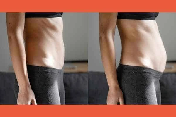 LA-EMS Body Sculpting results Bricket Wood