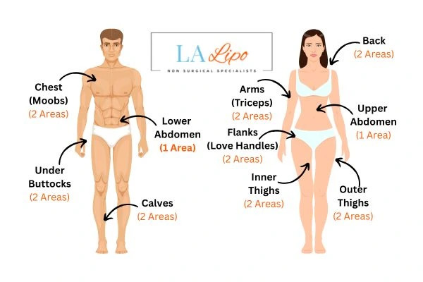 LA LIPO Cryolipolysis Areas Bricket Wood