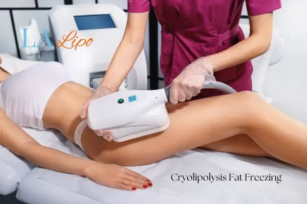 Woman receiving coolsculpting Bricket Wood treatment on her thighs