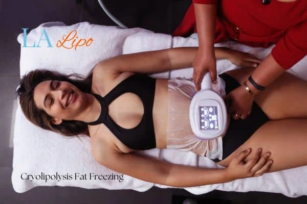 woman getting cryolipolysis Bricket Wood