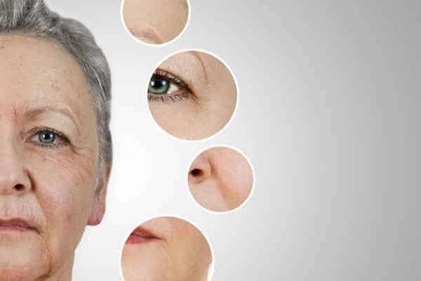 HIFU Facelift Bricket Wood from LA LIPO