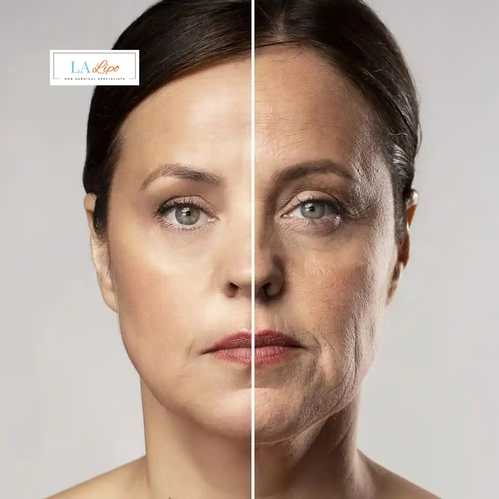 How Can You Tell If Non-Surgical Skin Tightening Is Right for You Bricket Wood?