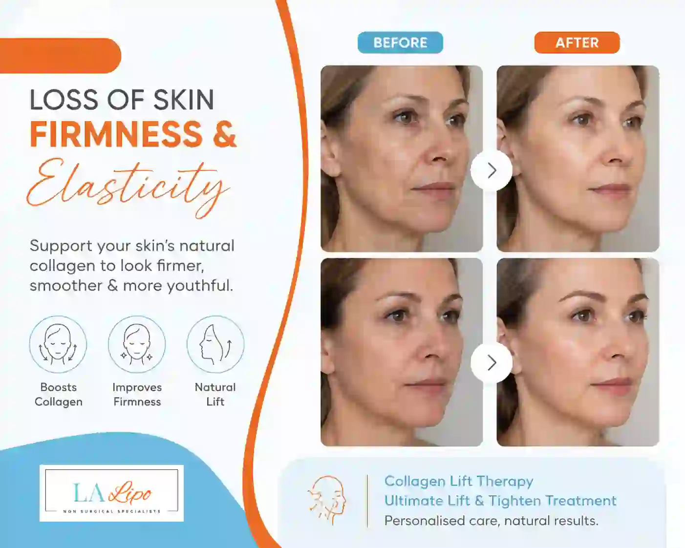 Sign #7: Loss of Skin Firmness and Elasticity Bricket Wood