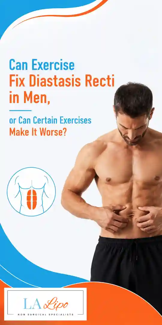 Can Exercise Fix Diastasis Recti in Men, or Can Certain Exercises Make It Worse Bricket Wood?