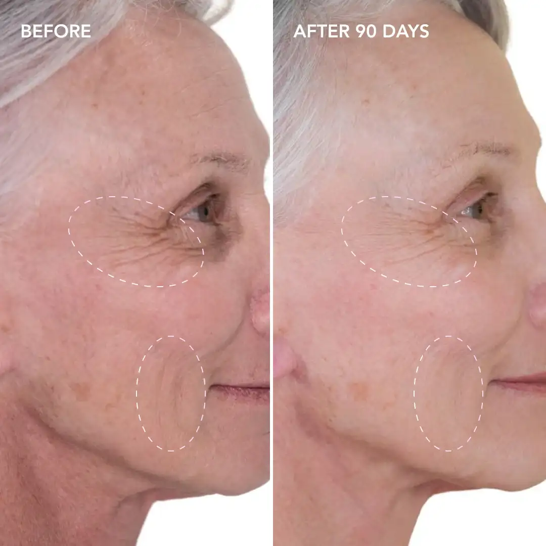 When will you see results Bricket Wood